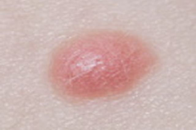 Moles