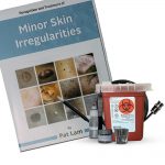 Minor Skin Irregularities